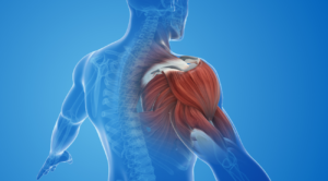 Los Angeles Shoulder Injury Lawyer